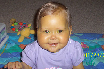 PatientStory_AbbyO_1