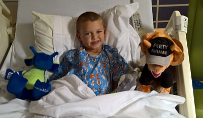 after+2nd+surgery+parotidectomy+2016