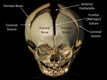 Frontal+Bone-345