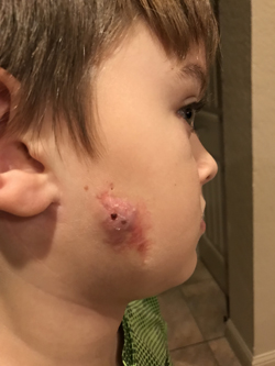 Jan+2019+before+surgery